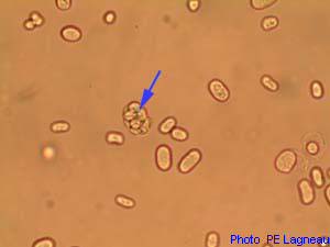 Aspect microscopiques montrant  un sporocyte contenant des endospores