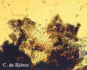 nombreuses pycnospores tricellulaires (souche isole de pommier)